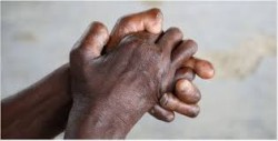 चितवनमा १८ जनामा कुष्ठरोगको सङ्क्रमण