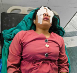 घाइते पत्रकार कार्कीमाथि भएको घटनाप्रति महासंघको ध्यानाकर्षण