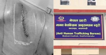 मानव अंग तस्करीमा संलग्न ‘र्‍याकेट’ पर्दाफास: श्याम कृष्ण भण्डारी पक्राउ,