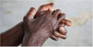 चितवनमा १८ जनामा कुष्ठरोगको सङ्क्रमण