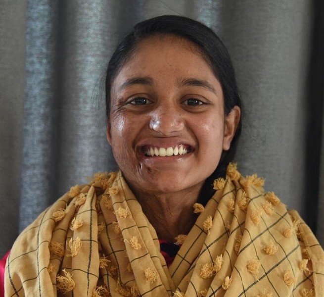 “एसिड आक्रमणबाट बचेकी अभियन्ता मुस्कान खातुन नेकपामा प्रवेश, प्रचण्ड नेतृत्वको पार्टीमा केन्द्रीय सदस्य बन्ने”