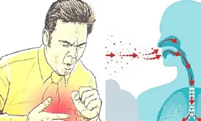 बर्दिबासमा क्षयरोगीको सङ्ख्या उच्च